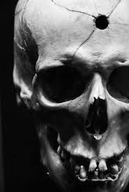 bullet entry wound skull